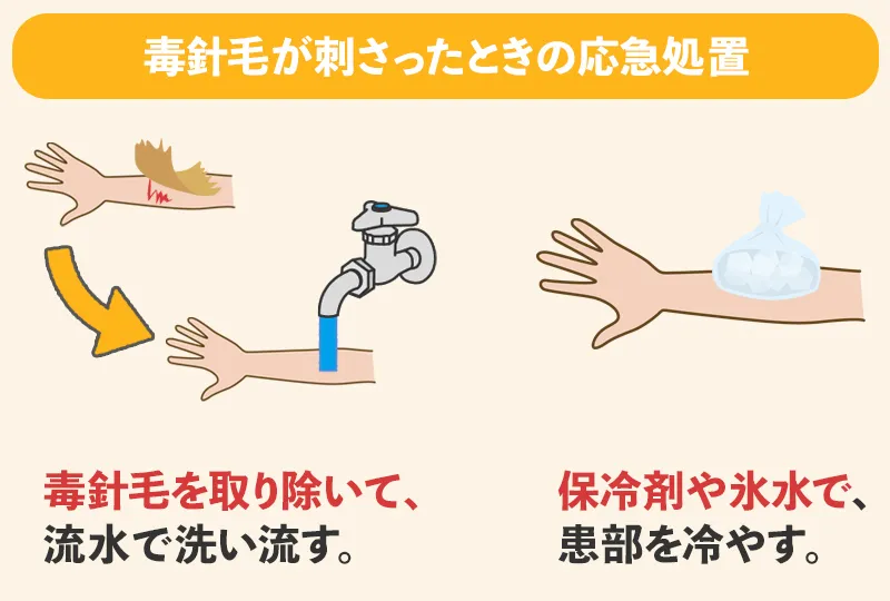 チャドクガに刺されたときの応急処置